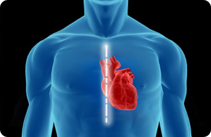 Cirurgia Cardiaca