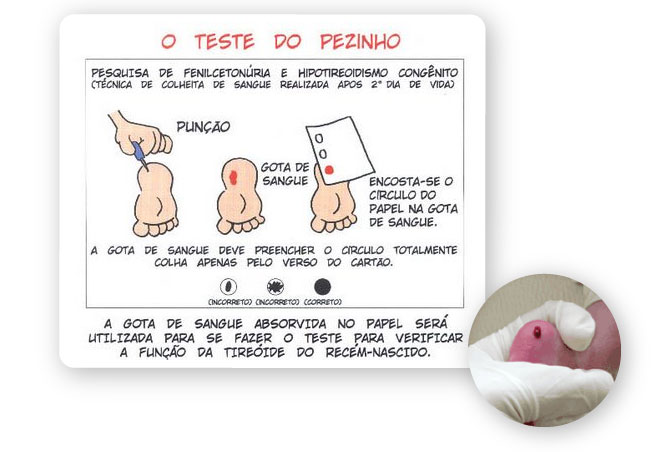 Maternidade - Teste do Pezinho